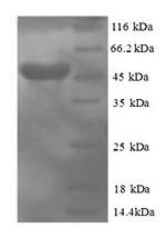 Recombinant Human Protein canopy homolog 2 (CNPY2) – Figure 1 of 1