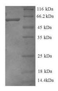 Recombinant Human Guanine nucleotide-binding protein G (I)/G (S)/G (T) subunit beta-2 (GNB2), partial – Figure 1 of 1
