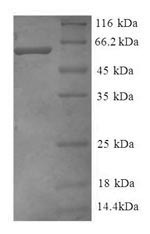 Recombinant Human Guanine nucleotide-binding protein G (I)/G (S)/G (T) subunit beta-2 (GNB2), partial – Figure 1 of 1