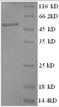 Recombinant Human Anaphase-promoting complex subunit 5 (ANAPC5), partial – Figure 1 of 1