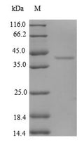 Recombinant Human Eukaryotic translation initiation factor 1 (EIF1) – Figure 1 of 1