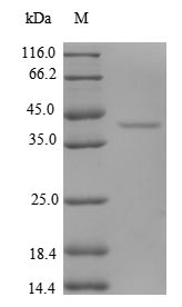 Recombinant Human Eukaryotic translation initiation factor 1 (EIF1) – Figure 1 of 1