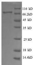 Recombinant Human Dolichyl-diphosphooligosaccharide--protein glycosyltransferase 48KDA subunit (RPN1), partial – Figure 1 of 