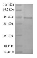 Recombinant Human Myosin light polypeptide 6 (MYL6), partial – Figure 1 of 1