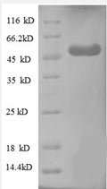 Recombinant Human WD repeat-containing protein 1 (WDR1), partial – Figure 1 of 1
