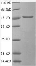 Recombinant Human Secretory carrier-associated membrane protein 3 (SCAMP3), partial – Figure 1 of 1