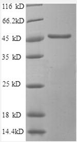 Recombinant Human Secretory carrier-associated membrane protein 3 (SCAMP3), partial – Figure 1 of 1