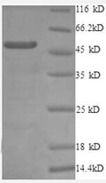 Recombinant Human 60S ribosomal protein L10a (RPL10A), partial – Figure 1 of 1