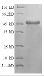 Recombinant Human NADH dehydrogenase [ubiquinone] flavoprotein 2, mitochondrial (NDUFV2), partial – Figure 1 of 1