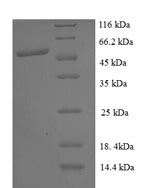 Recombinant Human PRKCA-binding protein (PICK1), partial – Figure 1 of 1
