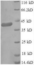 Recombinant Human Gamma-aminobutyric acid receptor-associated protein (GABARAP), partial – Figure 1 of 1