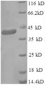 Recombinant Human Gamma-aminobutyric acid receptor-associated protein (GABARAP), partial – Figure 1 of 1