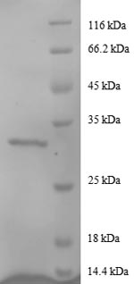 Recombinant Human Agouti-related protein (AGRP) – Figure 1 of 1