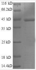 (Tris-Glycine gel) Discontinuous SDS-PAGE (reduced) with 5% enrichment gel and 15% separation gel.