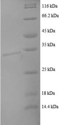 Recombinant Human C-C motif chemokine 22 (CCL22), partial – Figure 1 of 1