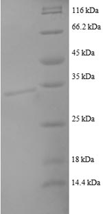 Recombinant Human C-C motif chemokine 22 (CCL22), partial – Figure 1 of 1