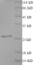 (Tris-Glycine gel) Discontinuous SDS-PAGE (reduced) with 5% enrichment gel and 15% separation gel.