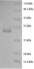 Recombinant Human Pro-epidermal growth factor (EGF)
, partial – Figure 1 of 1