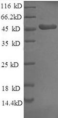Recombinant Human Fibroblast growth factor 19 protein (FGF-19)
, partial – Figure 1 of 1