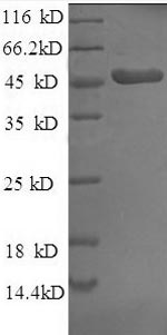 Recombinant Human Fibroblast growth factor 19 protein (FGF-19)
, partial – Figure 1 of 1