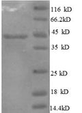 (Tris-Glycine gel) Discontinuous SDS-PAGE (reduced) with 5% enrichment gel and 15% separation gel.