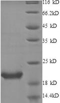 Recombinant Human Interleukin-1 receptor antagonist protein (IL1RN) – Figure 1 of 1