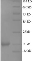 Recombinant Human Leptin (LEP), partial – Figure 1 of 1