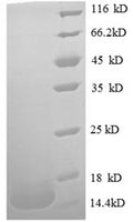 (Tris-Glycine gel) Discontinuous SDS-PAGE (reduced) with 5% enrichment gel and 15% separation gel.