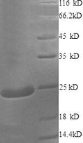 Recombinant Human Cysteine and glycine-rich protein 2 (CSRP2) – Figure 1 of 1