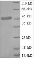 Recombinant Human Tumor necrosis factor receptor superfamily member 1A (TNFRSF1A), partial – Figure 1 of 1