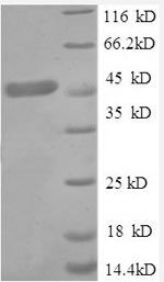 Recombinant Human Tumor necrosis factor receptor superfamily member 1A (TNFRSF1A), partial – Figure 1 of 1