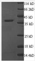 Recombinant Human Thrombospondin-1 (THBS1), partial – Figure 1 of 1