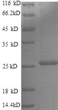 Recombinant Human Metalloproteinase inhibitor 4 (TIMP4), partial – Figure 1 of 1