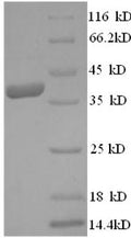 Recombinant Human Vascular endothelial growth factor D (FIGF) – Figure 1 of 1