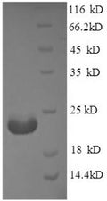 Recombinant Mouse Adiponectin (Adipoq), partial – Figure 1 of 1