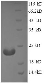 Recombinant Mouse Adiponectin (Adipoq), partial – Figure 1 of 1