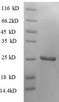 Recombinant Human Tumor necrosis factor ligand superfamily member 9 protein (TNFSF9), partial – Figure 1 of 1