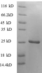 Recombinant Human Tumor necrosis factor ligand superfamily member 9 protein (TNFSF9), partial – Figure 1 of 1