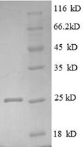 Recombinant Human Tumor necrosis factor receptor superfamily member 3 (LTBR), partial – Figure 1 of 1