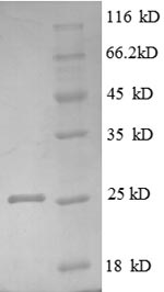 Recombinant Human Tumor necrosis factor receptor superfamily member 3 (LTBR), partial – Figure 1 of 1