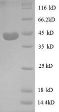 Recombinant Human Insulin-like growth factor II protein (PP1446), partial – Figure 1 of 1