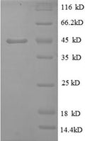 (Tris-Glycine gel) Discontinuous SDS-PAGE (reduced) with 5% enrichment gel and 15% separation gel.