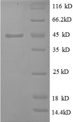 (Tris-Glycine gel) Discontinuous SDS-PAGE (reduced) with 5% enrichment gel and 15% separation gel.