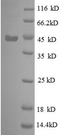 Recombinant Escherichia coli 30S ribosomal protein S6 (rpsF), partial – Figure 1 of 1