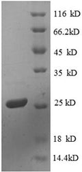 Recombinant Escherichia coli 30S ribosomal protein S4 (rpsD) – Figure 1 of 1