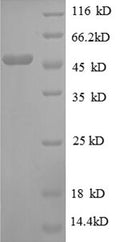 Recombinant Escherichia coli 30S ribosomal protein S3 (rpsC) – Figure 1 of 1