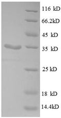 Recombinant Escherichia coli 30S ribosomal protein S21 (rpsU) – Figure 1 of 1