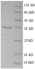 Recombinant Escherichia coli 30S ribosomal protein S21 (rpsU) – Figure 1 of 1