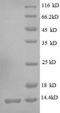 Recombinant Escherichia coli 30S ribosomal protein S19 (rpsS) – Figure 1 of 1