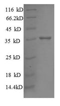 Recombinant Escherichia coli 30S ribosomal protein S18 (rpsR) – Figure 1 of 1